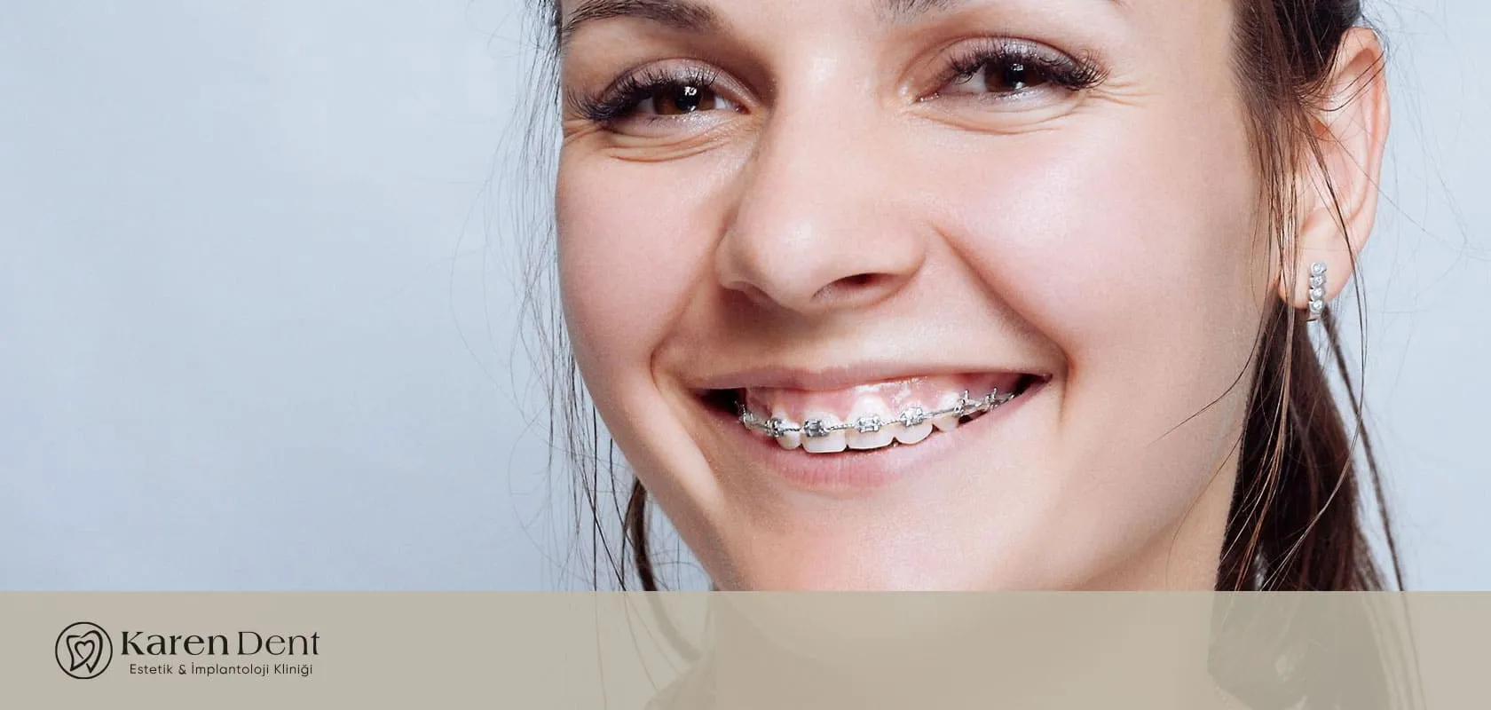 2016-yili-guncel-dis-teli-fiyat-araliklari