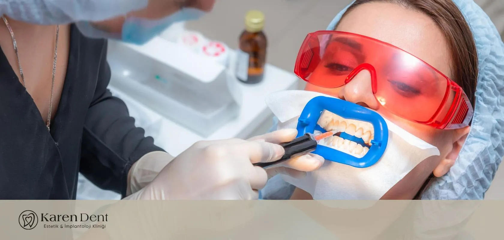 2026-dis-beyazlatma-fiyat-tablosu