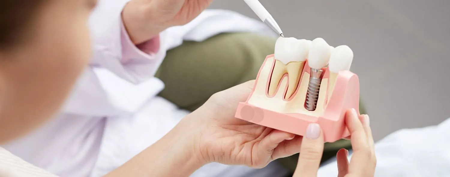 diş implantı