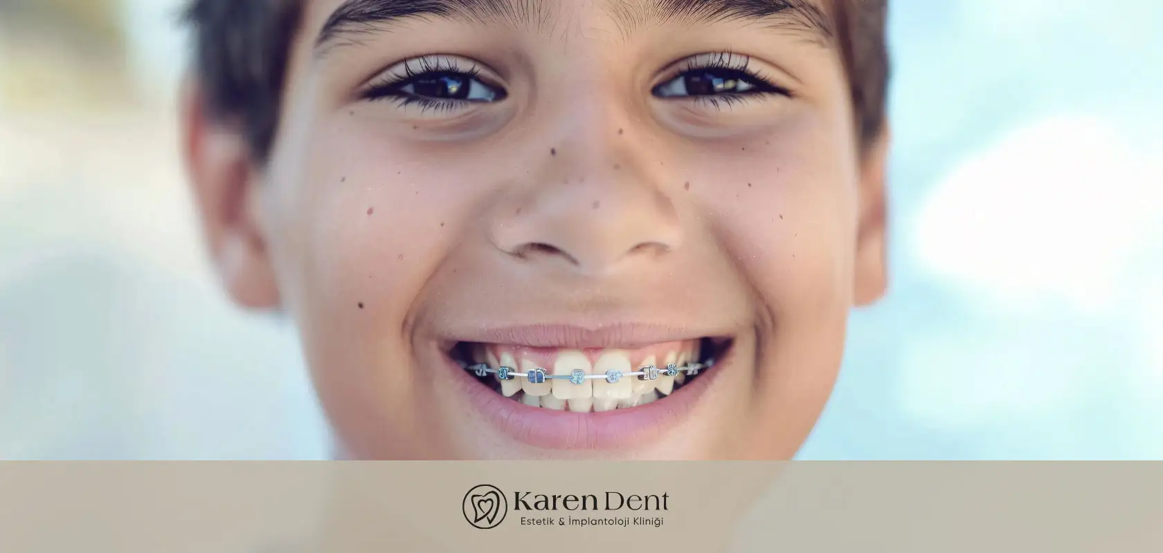 ortodonti-tedavisi-nedir