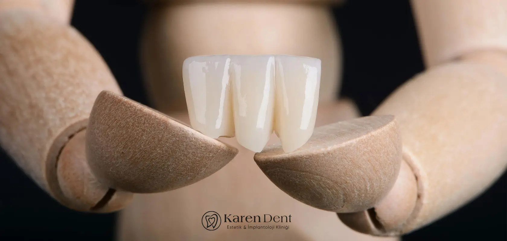 porselen-dis-kaplama-fiyatlari-2026