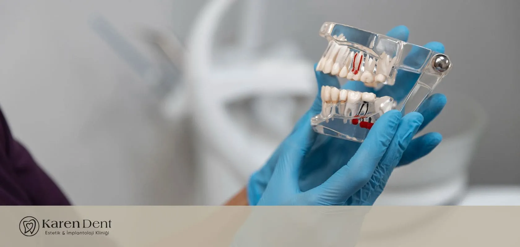 zirkonyum-ve-titanyum-dis-implanti